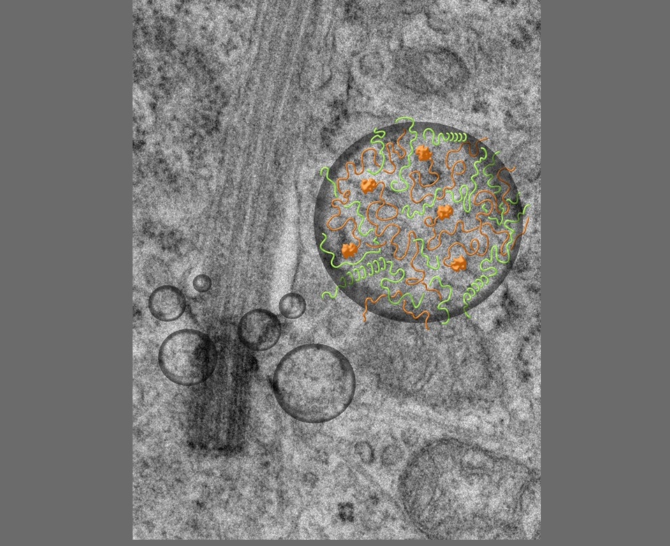 TTBK2與CEP164液態結合促成纖毛生長(此為示意圖)1
