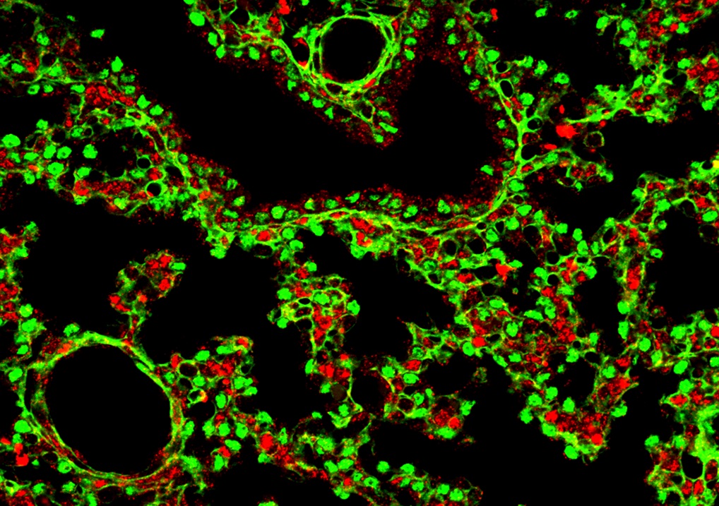 小鼠肺部的Nolz-1(紅色)與TTF-1(綠色)共軛焦圖像