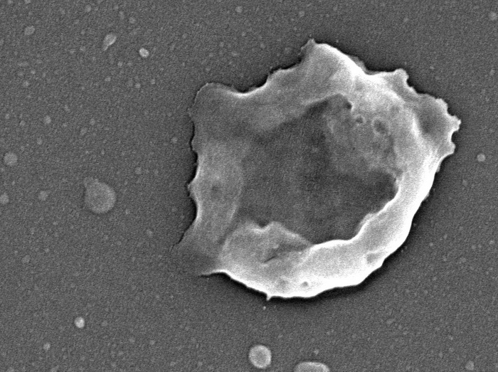 電子顯微鏡下去除碳酸鈣後的DNA膠囊