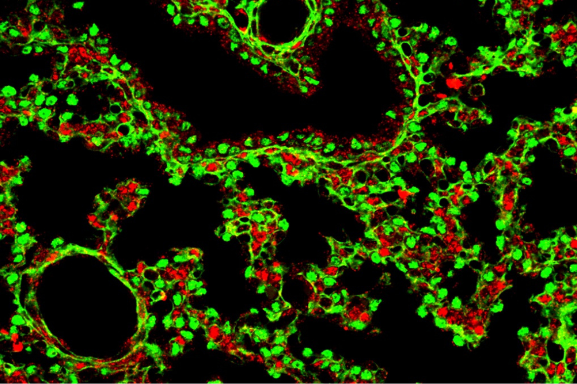 Confocal image of Nolz-1 (in red) and TTF-1 (in green) in the mouse lung.