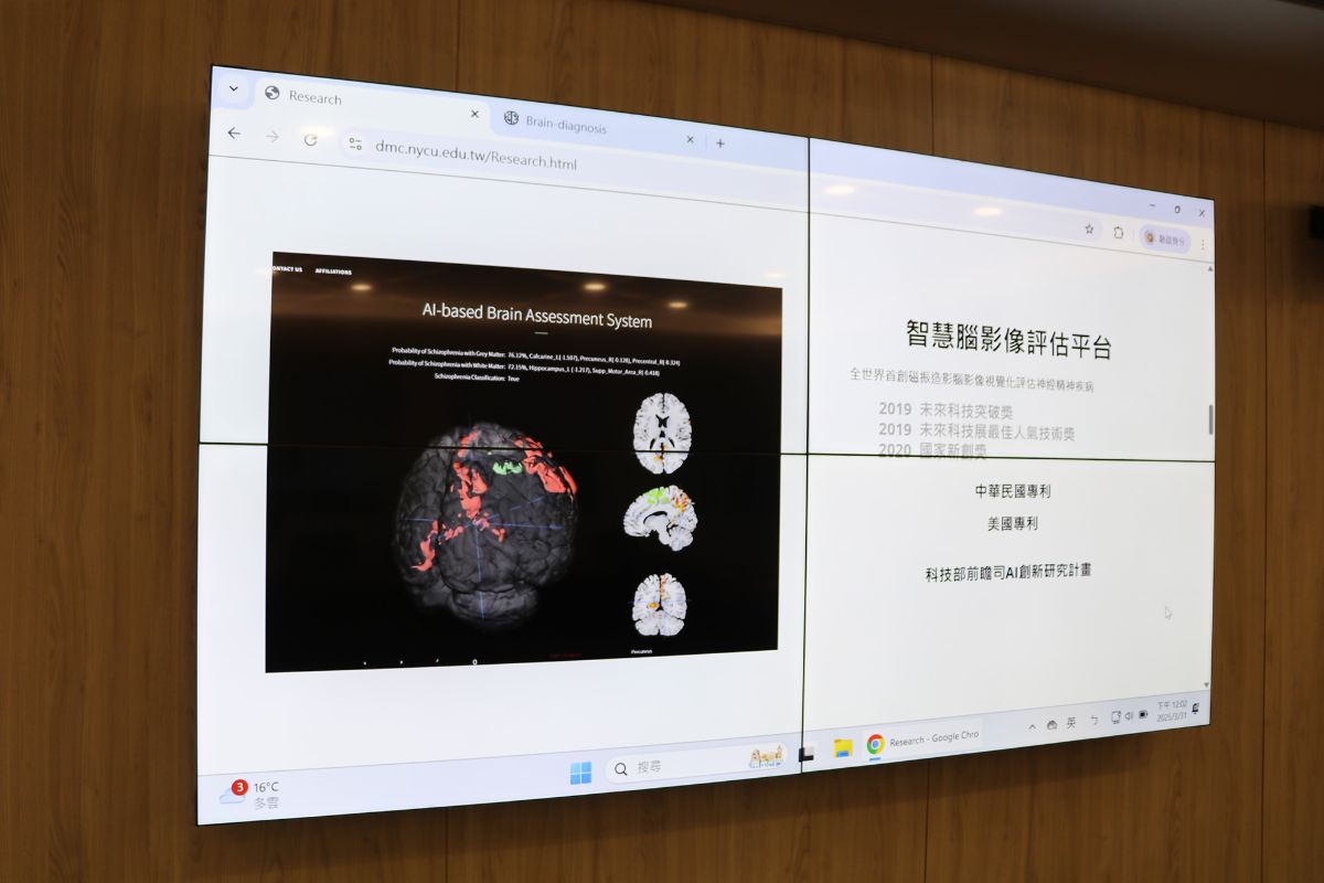 Brain imaging technology reveals disease-specific brain degeneration in psychiatric disorders, enabling targeted treatments and paving the way for early diagnosis of conditions like Alzheimer’s and Parkinson’s.