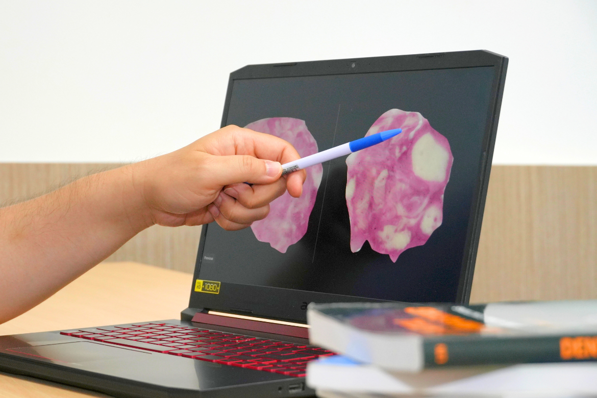 In the gummy candy experiment, participants with better chewing ability were able to mix the two-colored gummy more evenly.