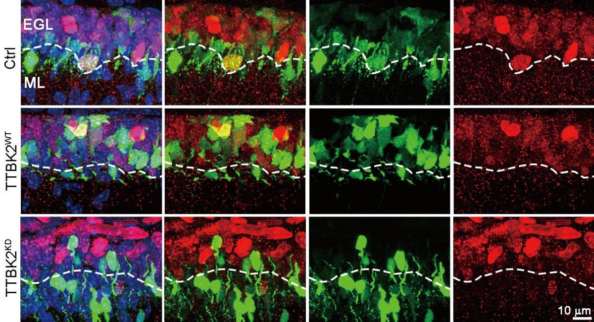 The discovery that TTBK2 activity promotes the proliferation of cerebellar GNPs highlights its critical role in brain development and disease.