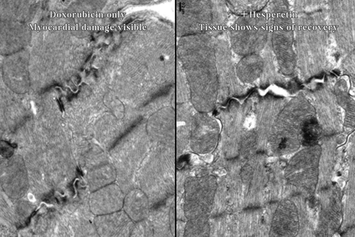Left: Cardiac cells of a mouse treated with Doxorubicin, showing dark canyon-like damage areas. Right: After hesperetin treatment, the damaged regions begin to recover.