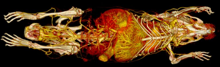 Contrast vascular imaging 3D simulation